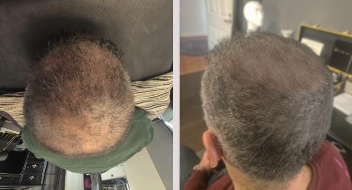 SMP resultat - Alan, Komplett SMP