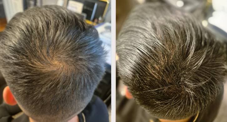 SMP collage - Joel före efter jämförelse