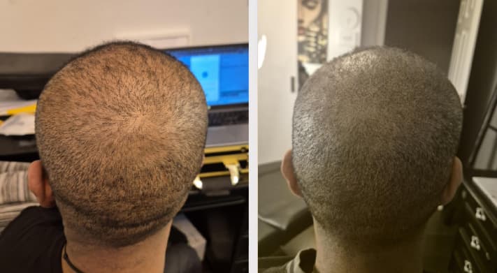 SMP resultat - Karim, Komplett SMP