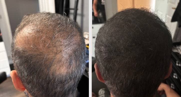 SMP bakifrån - Sarhane naturlig virvel