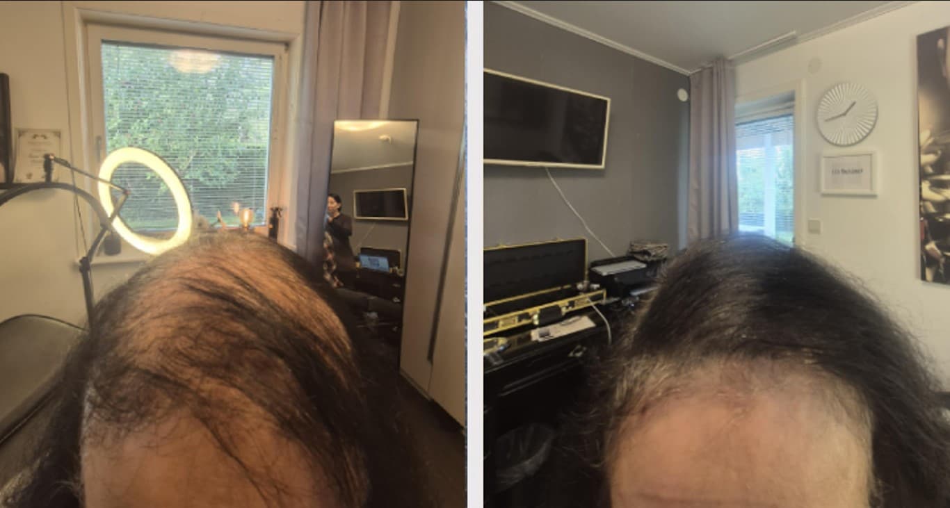 Hårtäthet kvinna - Sofia collage